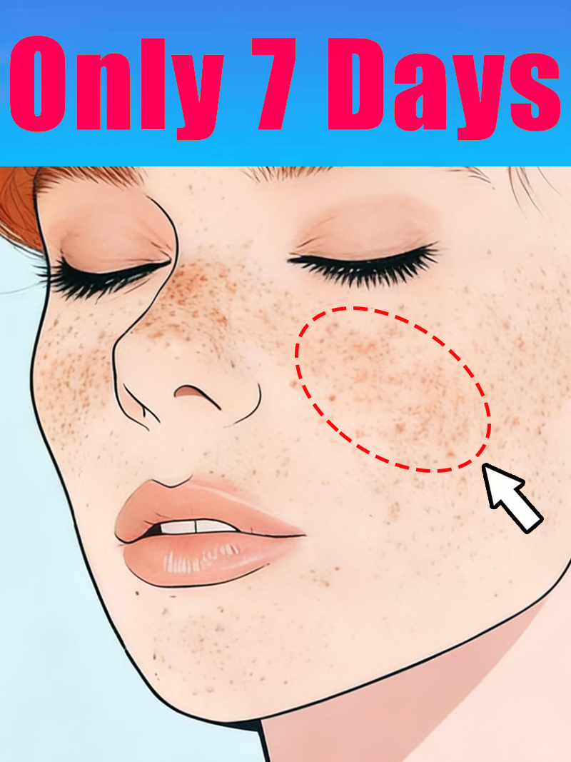Luxury Natural Skincare - Lightening Facial Freckles Melasma Dark Spots